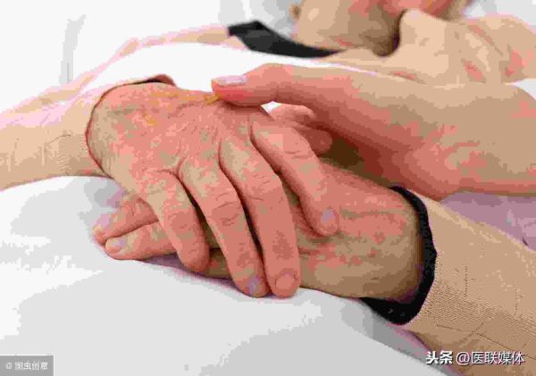 放疗和化疗有什么区别，哪个比较痛苦呢？