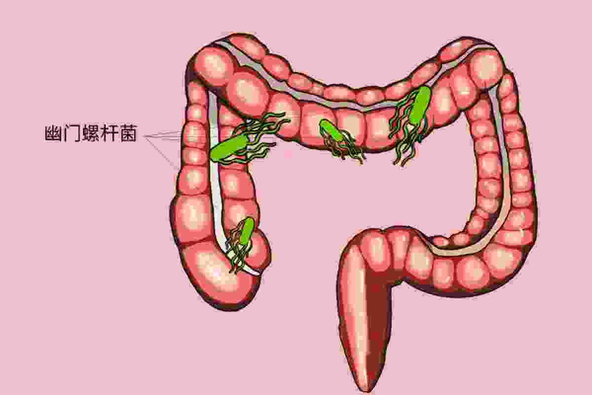 碳13与碳14有什么区别？碳十三与碳十四吹气选哪个