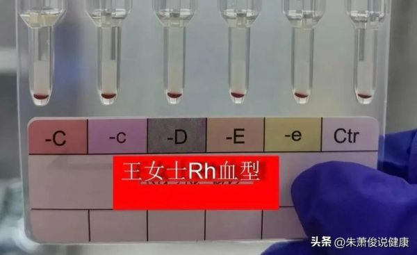 世界上最稀有的血型，全球不超过50人