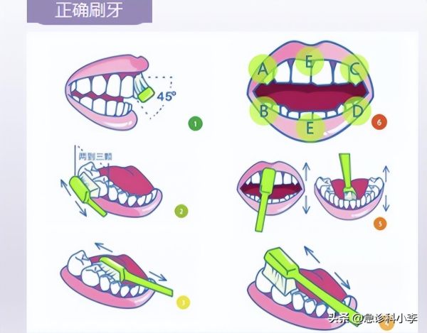 牙缝里的牙结石怎么清理，有3个办法可以选择哦